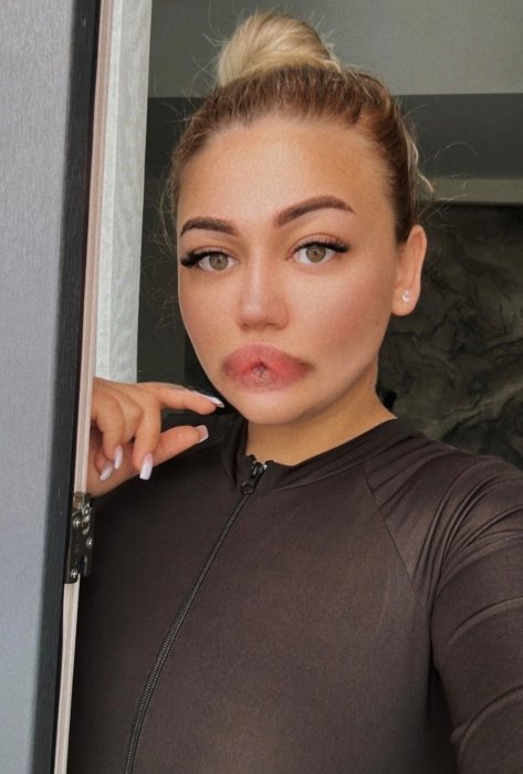 Anita - photo