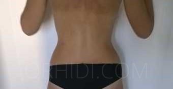 Nikol - photo